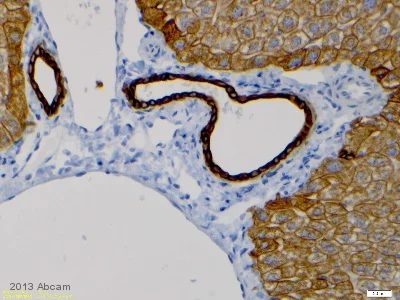 Immunohistochemistry (Formalin/PFA-fixed paraffin-embedded sections) - Anti-Cytokeratin 8 antibody [EP1628Y] - Cytoskeleton Marker (AB53280)