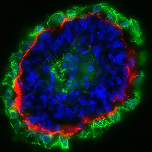 Immunohistochemistry (Frozen sections) - Anti-Cytokeratin 8 antibody [EP1628Y] - Cytoskeleton Marker (AB53280)