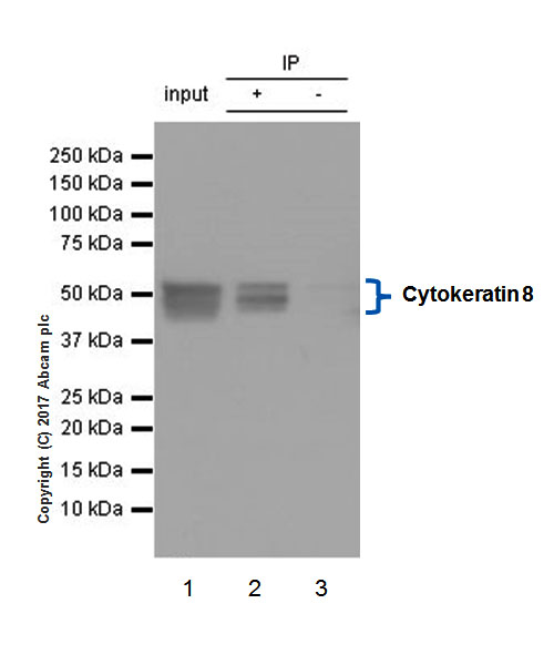 Immunoprecipitation - Anti-Cytokeratin 8 antibody [EP1628Y] - Cytoskeleton Marker (AB53280), expandable thumbnail