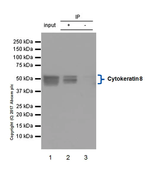 Immunoprecipitation - Anti-Cytokeratin 8 antibody [EP1628Y] - Cytoskeleton Marker (AB53280)