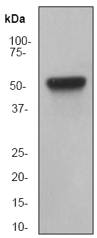 Western blot - Anti-Cytokeratin 8 antibody [EP1628Y] - Cytoskeleton Marker (ab53280), expandable thumbnail