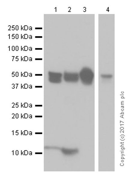 Anti-Cytokeratin 8 antibody [EP1628Y] - Cytoskeleton Marker