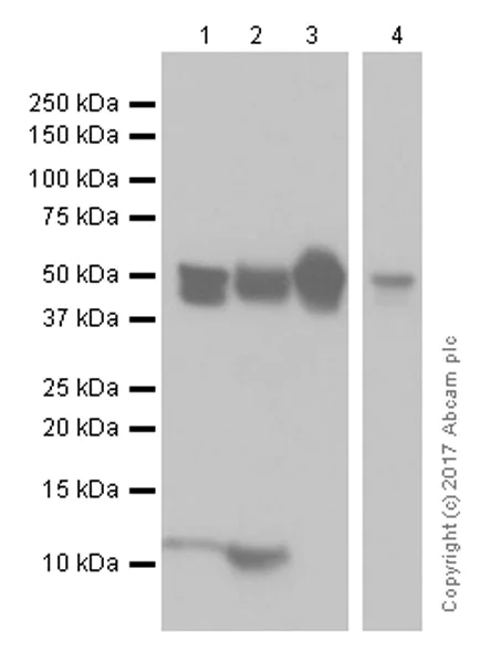 Western blot - Anti-Cytokeratin 8 antibody [EP1628Y] - Cytoskeleton Marker (AB53280)