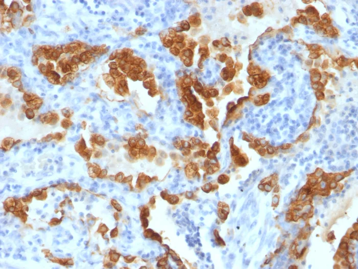 Immunohistochemistry (Formalin/PFA-fixed paraffin-embedded sections) - Anti-Cytokeratin 8 antibody [H1-TS1] (AB200547)