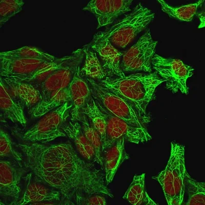 Immunocytochemistry - Anti-Cytokeratin 8 antibody [K8.8] (AB193346)