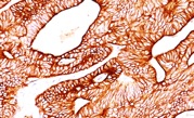 Immunohistochemistry (Formalin/PFA-fixed paraffin-embedded sections) - Anti-Cytokeratin 8 antibody [K8.8] (AB193346)