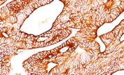 Immunohistochemistry (Formalin/PFA-fixed paraffin-embedded sections) - Anti-Cytokeratin 8 antibody [K8.8] (AB193346)