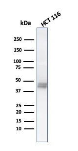 Western blot - Anti-Cytokeratin 8 antibody [K8.8] (AB193346)