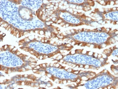 Immunohistochemistry (Formalin/PFA-fixed paraffin-embedded sections) - Anti-Cytokeratin 8 antibody [KRT8/2174R] (AB234348)
