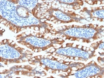 Immunohistochemistry (Formalin/PFA-fixed paraffin-embedded sections) - Anti-Cytokeratin 8 antibody [KRT8/2174R] - BSA and Azide free (AB236270), expandable thumbnail