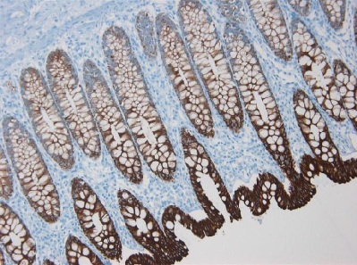 Immunohistochemistry (Formalin/PFA-fixed paraffin-embedded sections) - Anti-Cytokeratin 8 antibody [M20] - Cytoskeleton Marker (ab9023), expandable thumbnail