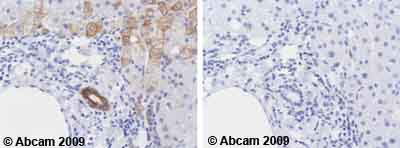 Immunohistochemistry (Formalin/PFA-fixed paraffin-embedded sections) - Anti-Cytokeratin 8 antibody [M20] - Cytoskeleton Marker (ab9023), expandable thumbnail