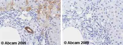 Immunohistochemistry (Formalin/PFA-fixed paraffin-embedded sections) - Anti-Cytokeratin 8 antibody [M20] - Cytoskeleton Marker (AB9023)
