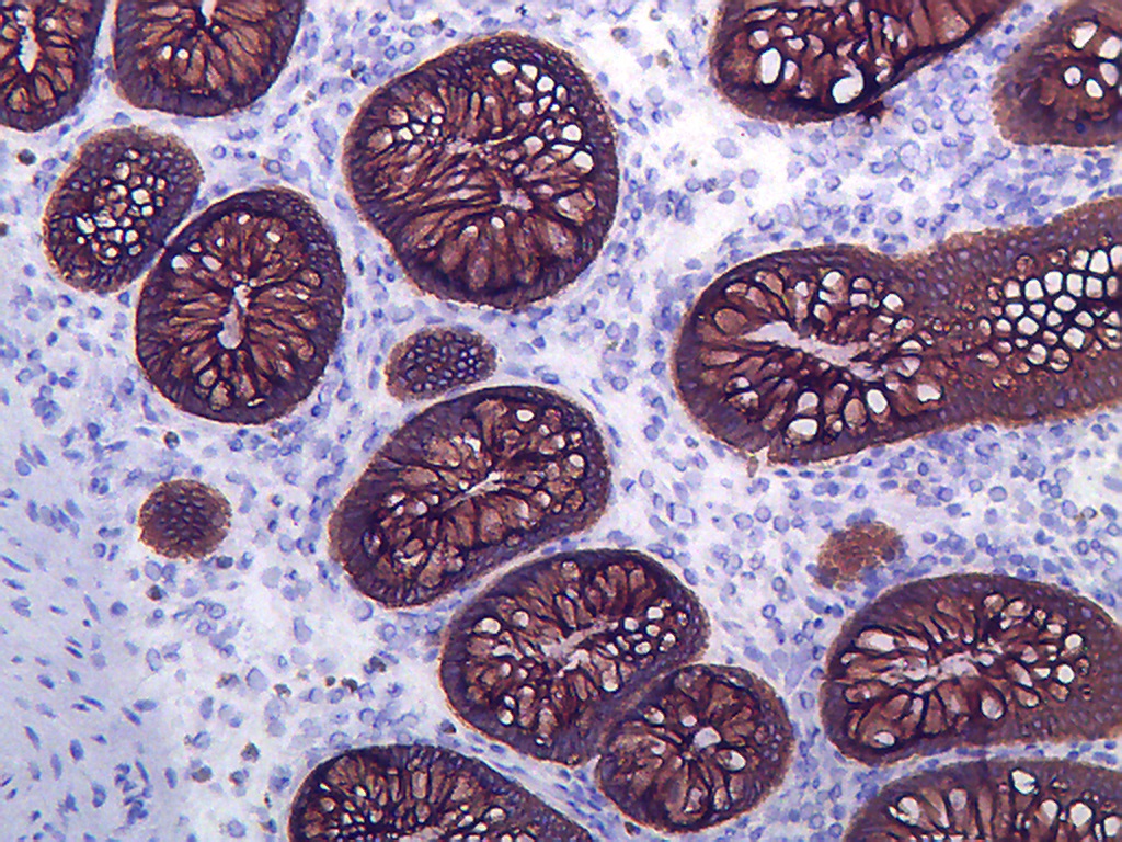 Immunohistochemistry (Frozen sections) - Anti-Cytokeratin 8 antibody [M20] - Cytoskeleton Marker (AB9023), expandable thumbnail