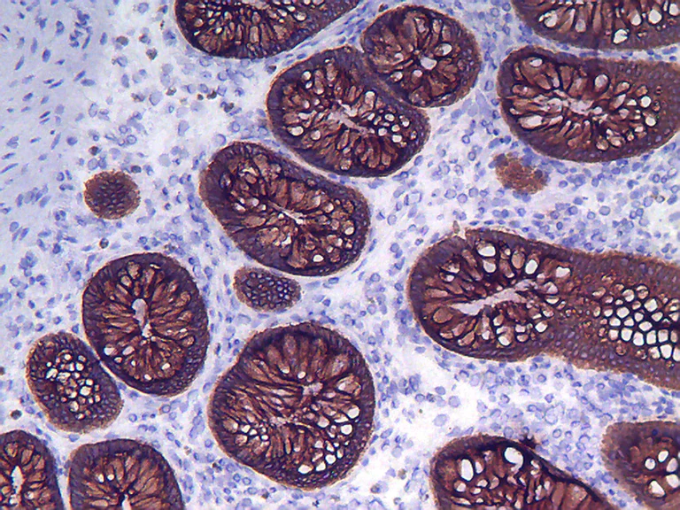 Immunohistochemistry (Frozen sections) - Anti-Cytokeratin 8 antibody [M20] - Cytoskeleton Marker (AB9023)