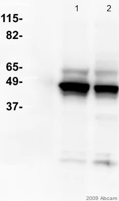 Western blot - Anti-Cytokeratin 8 antibody [M20] - Cytoskeleton Marker (AB9023)