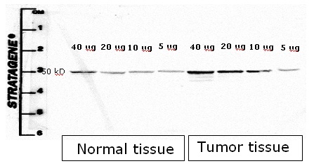 Western blot - Anti-Cytokeratin 8 antibody [M20] - Cytoskeleton Marker (AB9023), expandable thumbnail