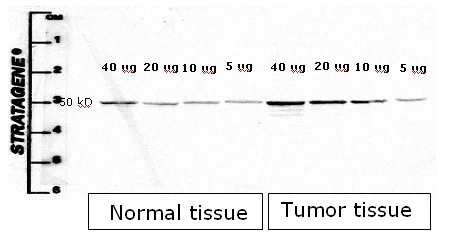 Western blot - Anti-Cytokeratin 8 antibody [M20] - Cytoskeleton Marker (AB9023)