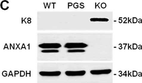 Western blot - Anti-Cytokeratin 8 antibody [M20] - Cytoskeleton Marker (ab9023), expandable thumbnail
