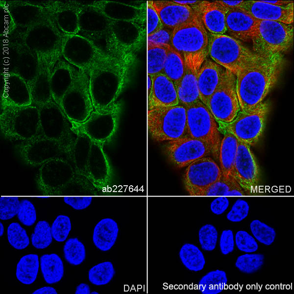 Immunocytochemistry/ Immunofluorescence - Anti-Cytokeratin 8 antibody [SP102] - BSA and Azide free (AB240986), expandable thumbnail