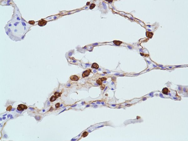 Immunohistochemistry (Formalin/PFA-fixed paraffin-embedded sections) - Anti-Cytokeratin 8 antibody [SP102] - BSA and Azide free (ab240986), expandable thumbnail