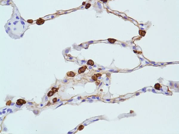 Immunohistochemistry (Formalin/PFA-fixed paraffin-embedded sections) - Anti-Cytokeratin 8 antibody [SP102] - BSA and Azide free (AB240986)