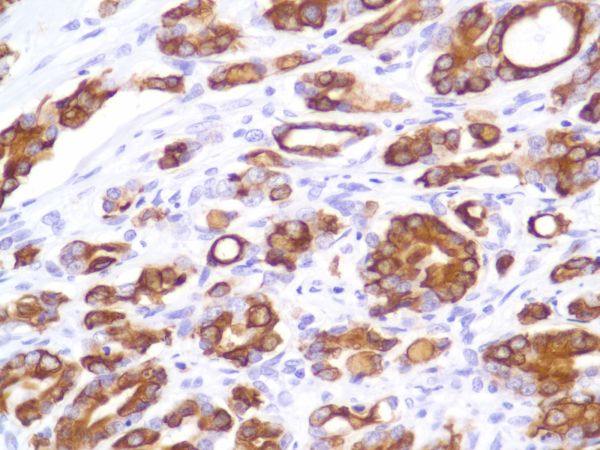 Immunohistochemistry (Formalin/PFA-fixed paraffin-embedded sections) - Anti-Cytokeratin 8 antibody [SP102] - BSA and Azide free (ab240986), expandable thumbnail
