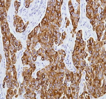 Immunohistochemistry (Formalin/PFA-fixed paraffin-embedded sections) - Anti-Cytokeratin 8 antibody [SP102] - BSA and Azide free (AB240986), expandable thumbnail