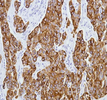 Immunohistochemistry (Formalin/PFA-fixed paraffin-embedded sections) - Anti-Cytokeratin 8 antibody [SP102] - BSA and Azide free (AB240986)