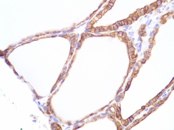 Immunohistochemistry (Formalin/PFA-fixed paraffin-embedded sections) - Anti-Cytokeratin 8 antibody [SP102] - BSA and Azide free (ab240986), expandable thumbnail