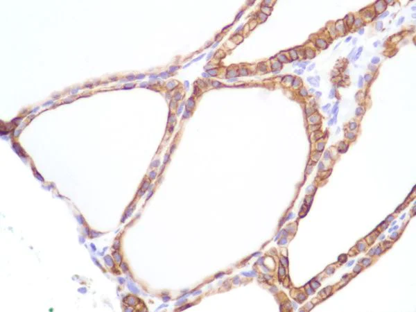 Immunohistochemistry (Formalin/PFA-fixed paraffin-embedded sections) - Anti-Cytokeratin 8 antibody [SP102] - BSA and Azide free (AB240986)