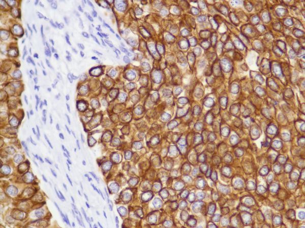 Immunohistochemistry (Formalin/PFA-fixed paraffin-embedded sections) - Anti-Cytokeratin 8 antibody [SP102] - BSA and Azide free (ab240986), expandable thumbnail
