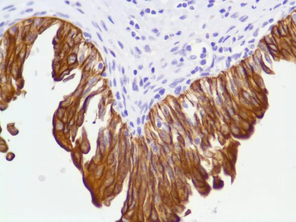 Immunohistochemistry (Formalin/PFA-fixed paraffin-embedded sections) - Anti-Cytokeratin 8 antibody [SP102] - BSA and Azide free (AB240986)