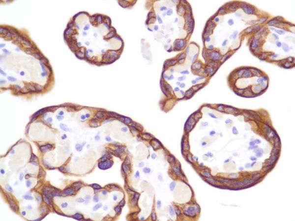 Immunohistochemistry (Formalin/PFA-fixed paraffin-embedded sections) - Anti-Cytokeratin 8 antibody [SP102] - BSA and Azide free (ab240986), expandable thumbnail