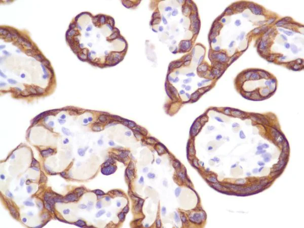 Immunohistochemistry (Formalin/PFA-fixed paraffin-embedded sections) - Anti-Cytokeratin 8 antibody [SP102] - BSA and Azide free (AB240986)