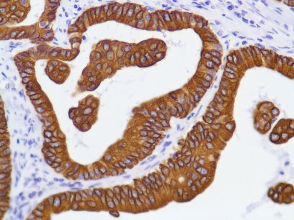 Immunohistochemistry (Formalin/PFA-fixed paraffin-embedded sections) - Anti-Cytokeratin 8 antibody [SP102] - BSA and Azide free (ab240986), expandable thumbnail