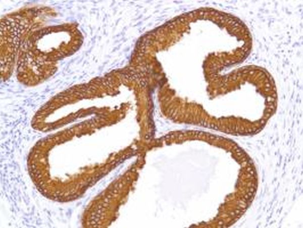 Immunohistochemistry (Formalin/PFA-fixed paraffin-embedded sections) - Anti-Cytokeratin 8 antibody [SP102] - BSA and Azide free (ab240986), expandable thumbnail