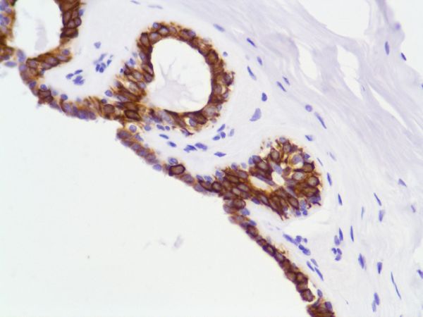 Immunohistochemistry (Formalin/PFA-fixed paraffin-embedded sections) - Anti-Cytokeratin 8 antibody [SP102] - BSA and Azide free (ab240986), expandable thumbnail