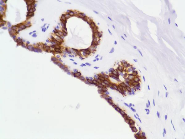 Immunohistochemistry (Formalin/PFA-fixed paraffin-embedded sections) - Anti-Cytokeratin 8 antibody [SP102] - BSA and Azide free (AB240986)