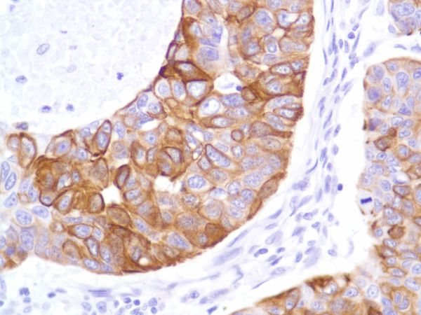 Immunohistochemistry (Formalin/PFA-fixed paraffin-embedded sections) - Anti-Cytokeratin 8 antibody [SP102] - BSA and Azide free (ab240986), expandable thumbnail