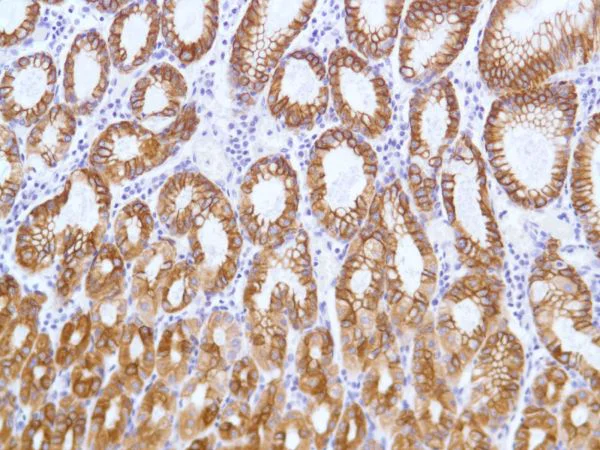 Immunohistochemistry (Formalin/PFA-fixed paraffin-embedded sections) - Anti-Cytokeratin 8 antibody [SP102] - BSA and Azide free (AB240986)