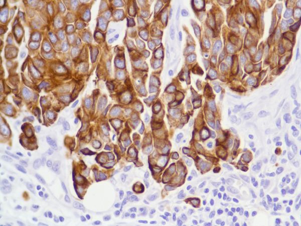 Immunohistochemistry (Formalin/PFA-fixed paraffin-embedded sections) - Anti-Cytokeratin 8 antibody [SP102] - BSA and Azide free (ab240986), expandable thumbnail