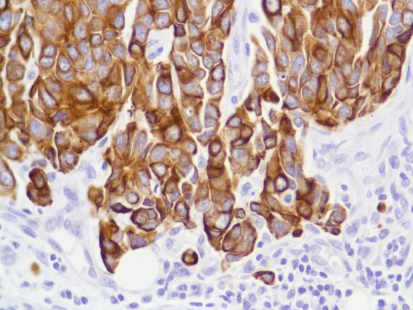 Immunohistochemistry (Formalin/PFA-fixed paraffin-embedded sections) - Anti-Cytokeratin 8 antibody [SP102] - BSA and Azide free (AB240986)