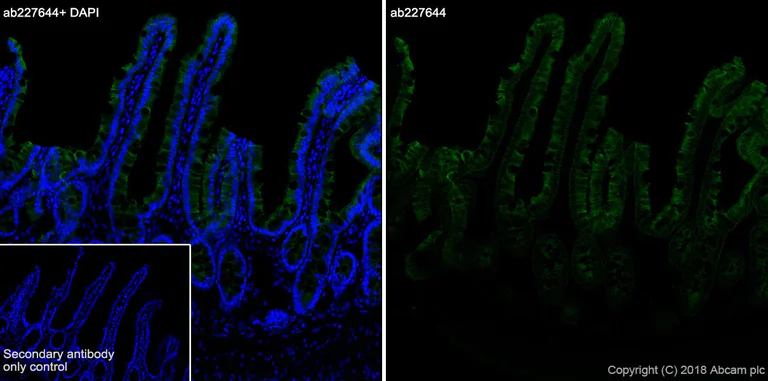 Immunohistochemistry (Frozen sections) - Anti-Cytokeratin 8 antibody [SP102] - C-terminal (AB227644)