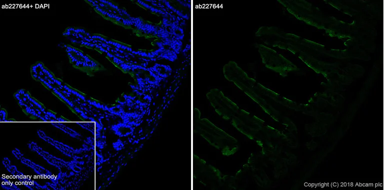 Immunohistochemistry (Frozen sections) - Anti-Cytokeratin 8 antibody [SP102] - C-terminal (AB227644)