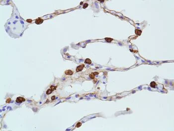 Immunohistochemistry (Formalin/PFA-fixed paraffin-embedded sections) - Anti-Cytokeratin 8 antibody [SP102], prediluted (AB228149)