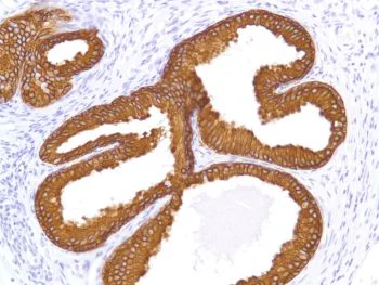 Immunohistochemistry (Formalin/PFA-fixed paraffin-embedded sections) - Anti-Cytokeratin 8 antibody [SP102], prediluted (AB228149)