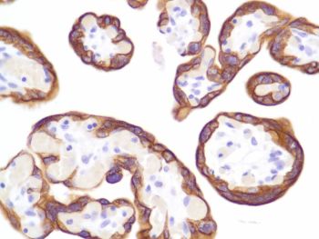 Immunohistochemistry (Formalin/PFA-fixed paraffin-embedded sections) - Anti-Cytokeratin 8 antibody [SP102], prediluted (AB228149)
