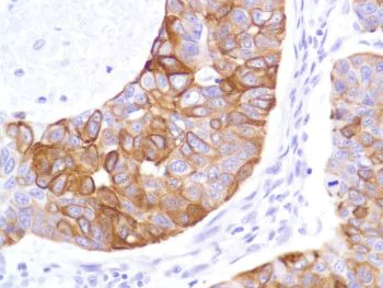 Immunohistochemistry (Formalin/PFA-fixed paraffin-embedded sections) - Anti-Cytokeratin 8 antibody [SP102], prediluted (AB228149)