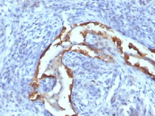 Immunohistochemistry (Formalin/PFA-fixed paraffin-embedded sections) - Anti-Cytokeratin 8 antibody [SPM538] - BSA and Azide free (AB212535)